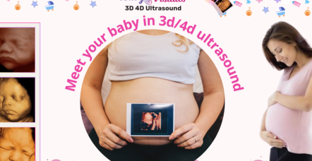 3d4d-baby-visual-750x465 (1)
