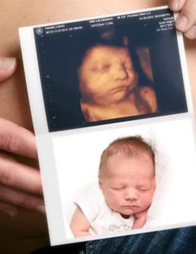 ultrasound-Paris-Canada-Baby-Visuals-1