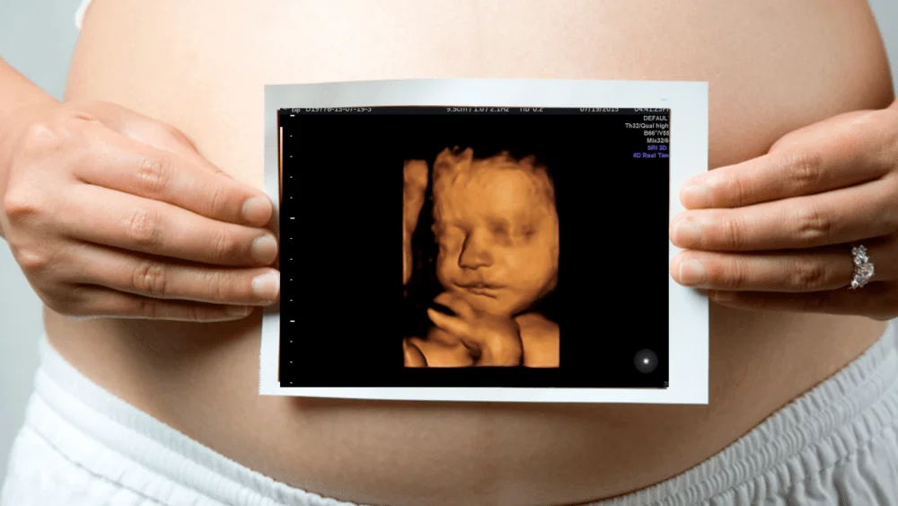 ultrasound-Paris-Canada-Baby-Visuals-2