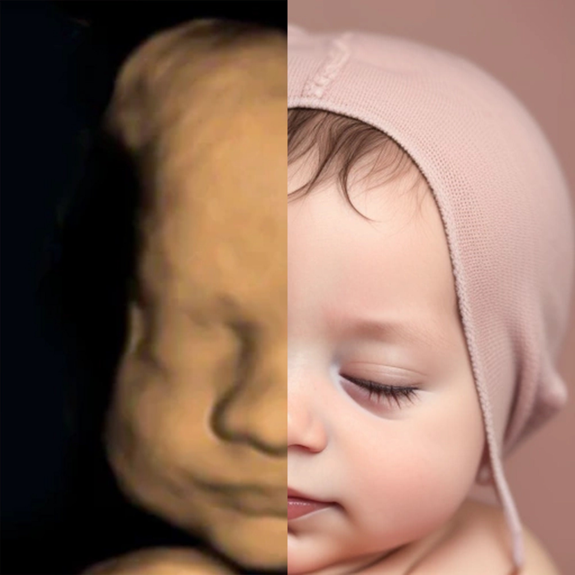 ultrasound-Woodstock-Baby-Visuals-1