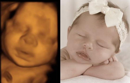 ultrasound-Woodstock-Baby-Visuals